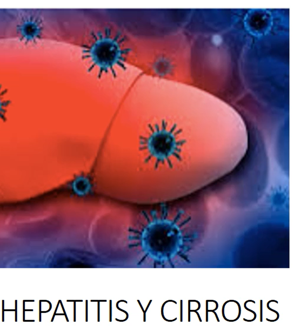 Seminario 8. Patología hepática no neoplásica y cirrosis